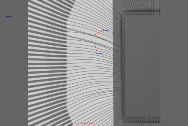 鍵合絲相交 鍵合絲相交